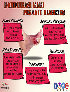 Komplikasi Kaki Pesakit Diabetes